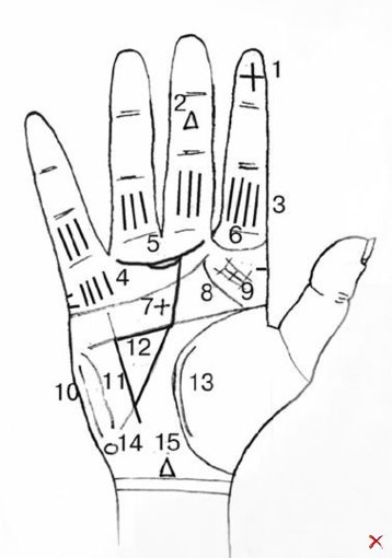 10415