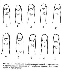 hl1-11.jpg hl1-11.jpg
